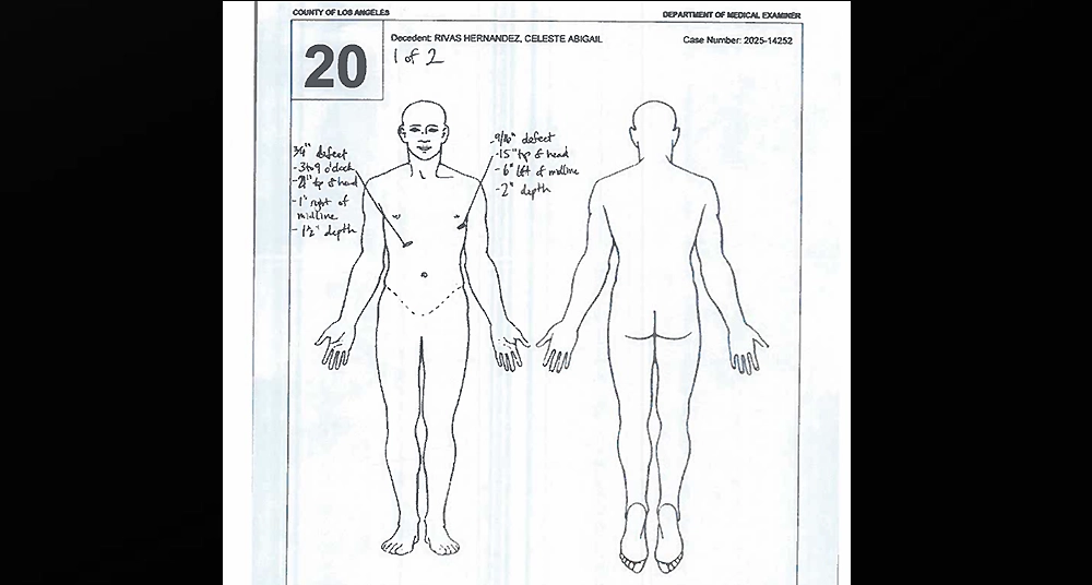 A diagram from the autopsy performed on Celeste Rivas Hernandez (Credit: LA County Medical Examiner)
